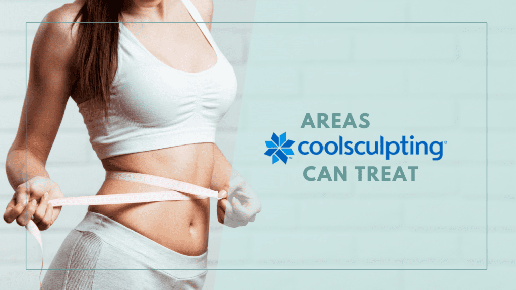 A person wearing a white sports bra and shorts measures their waist with a tape measure. Text on the image reads: "Areas CoolSculpting Can Treat." Discover the beauty of CoolSculpting at our medspa.