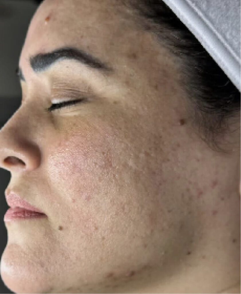 Close-up of a woman's face with natural skin