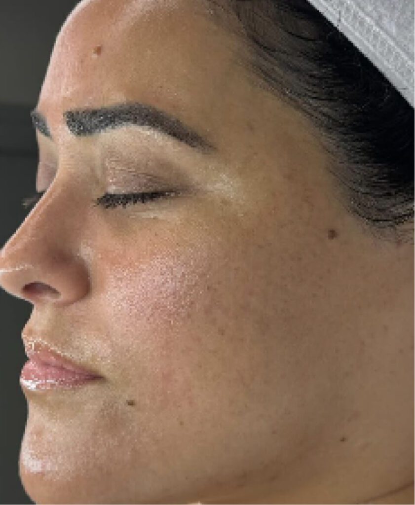 Close-up of woman's smooth skin after facial treatment.