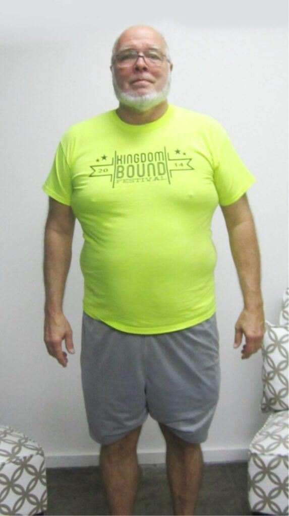 Man in yellow T-shirt and gray shorts standing