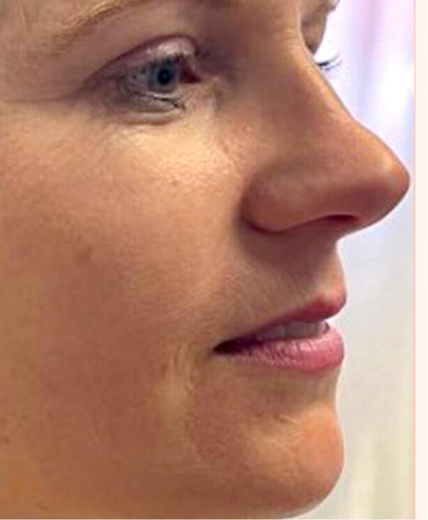 Close-up of a woman's face in profile.